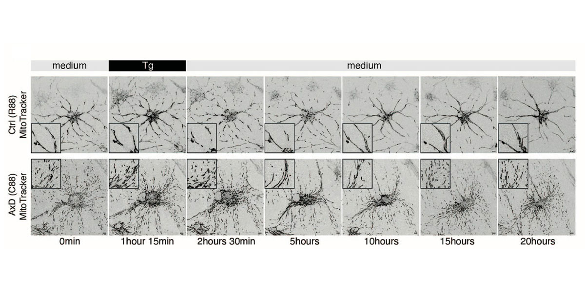 cientists demonstrated that glial fibrillary acidic protein (GFAP) promotes mitochondrial fission rather than blocking fusion. The genetic disorder Alexander disease is caused by mutations in the gene housing the instructions for GFAP. Image credit: Su-Chu