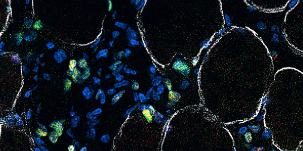 After an injury muscle stem cells activate and must expand in number to repair and make new muscle - marked by dystrophin in white - Stem cells at different stages of making muscle are stained in red green and yellow
