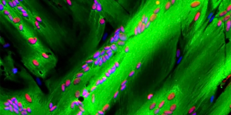 Myogenic determination gene number 1 (MYOD) protein immunofluorescence in myofibers