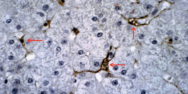 human hepatic stellate cells - Image courtesy of the American Association of Anatomy