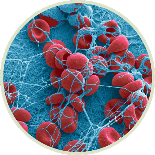  Colorized scanning electron micrograph of a blood clot