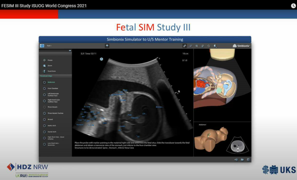 ultrasound study.png