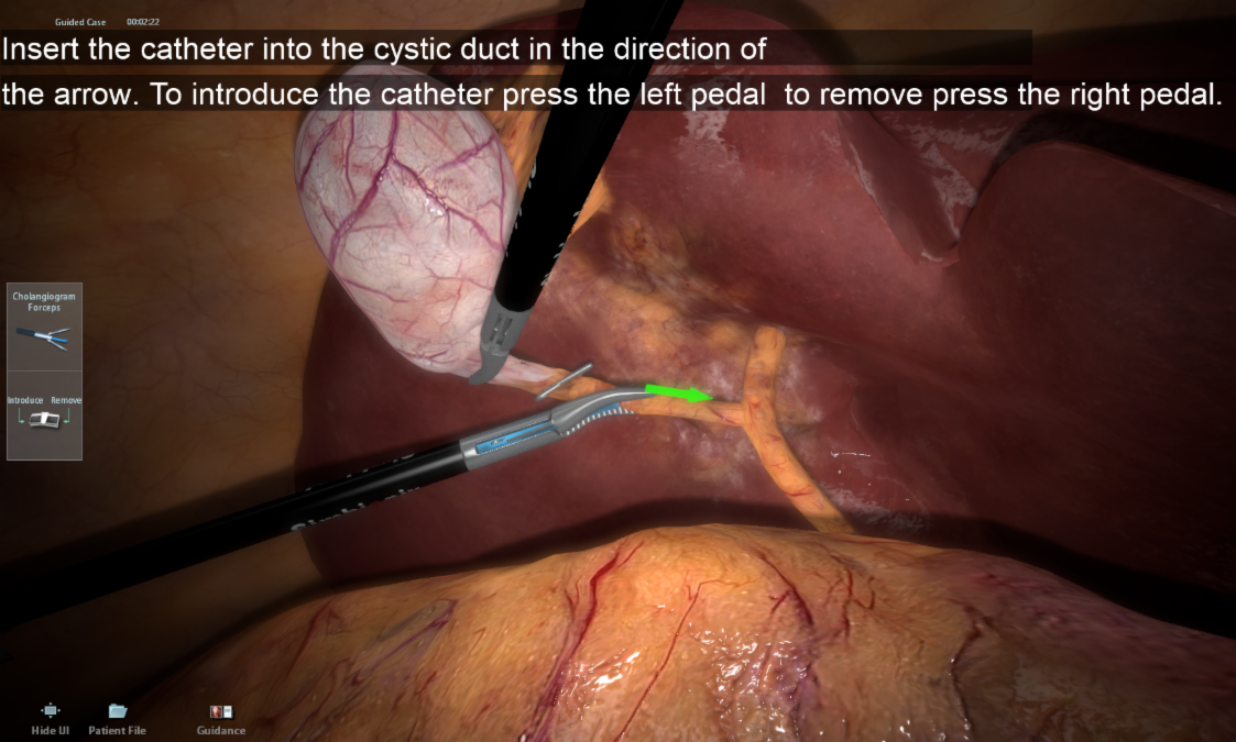 LAP Cholangiography.png