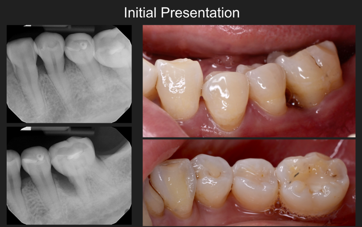 Initial clinical findings