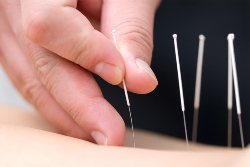 acupuncture_hand_back.jpg