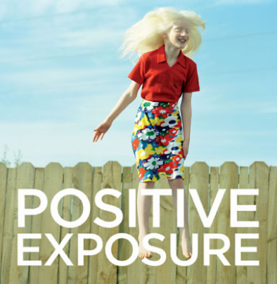 Positive Exposure logo featuring a smiling child with light-colored hair standing on a wooden fence, wearing a red shirt and a colorful floral skirt against a blue sky. The words "Positive Exposure" appear in large white text across the bottom.