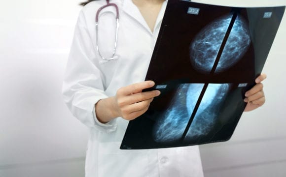 Radiologia-580x360.jpg