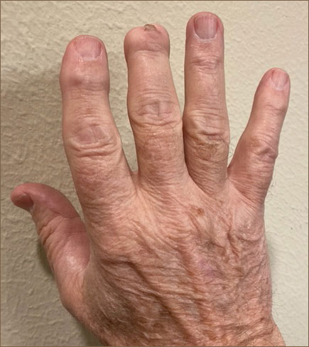Hugh hand