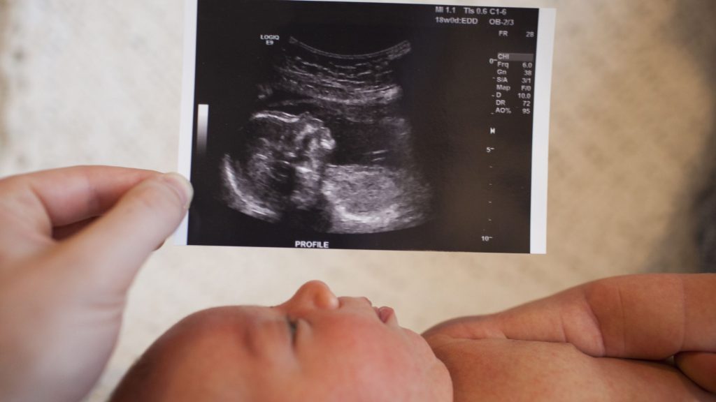 ultrasound1-1024x576.jpg