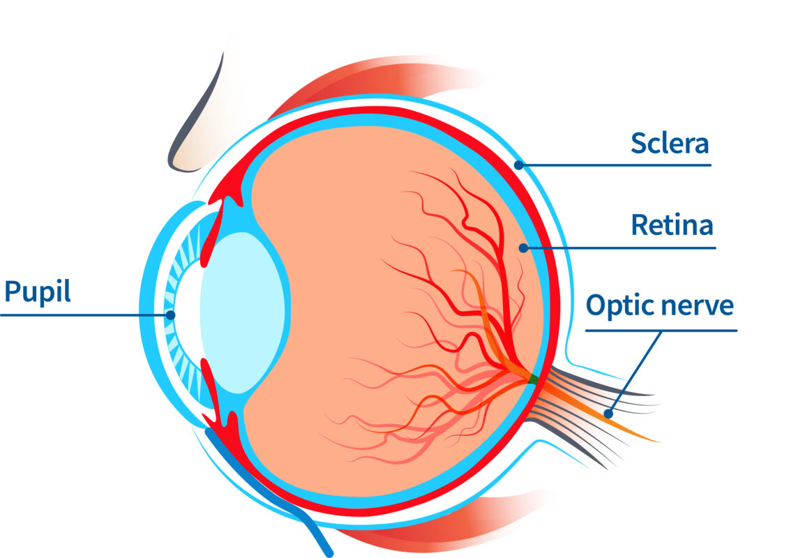 A diagram of the eye with labels for the pupil at the front of the eye and the sclera, retina, and optic nerve at the back of the eye. Many blood vessels branch off from the optic nerve and spread out into the eye.  