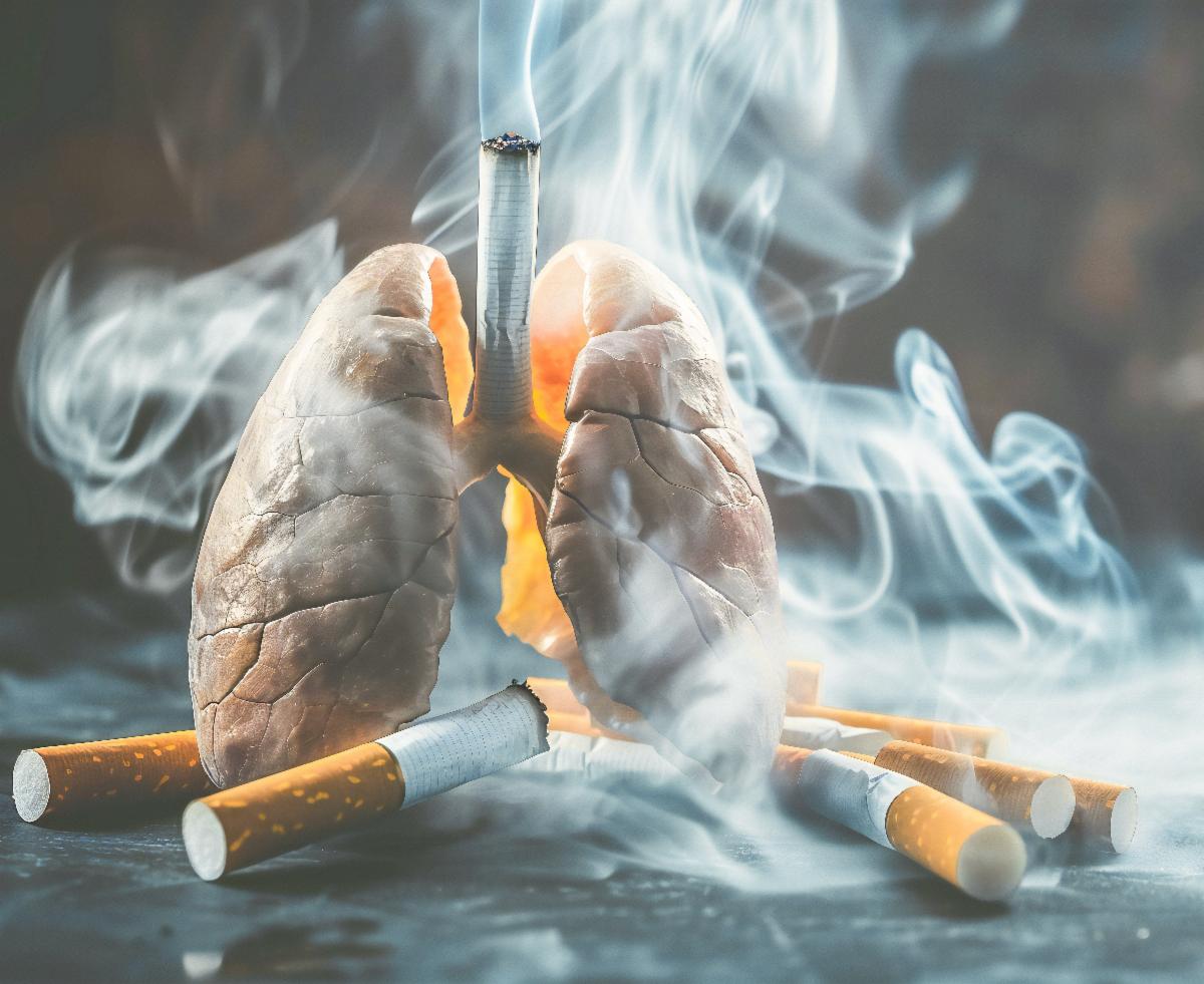 AI-generated image of blackened lungs surrounded by cigarettes with smoke coming out