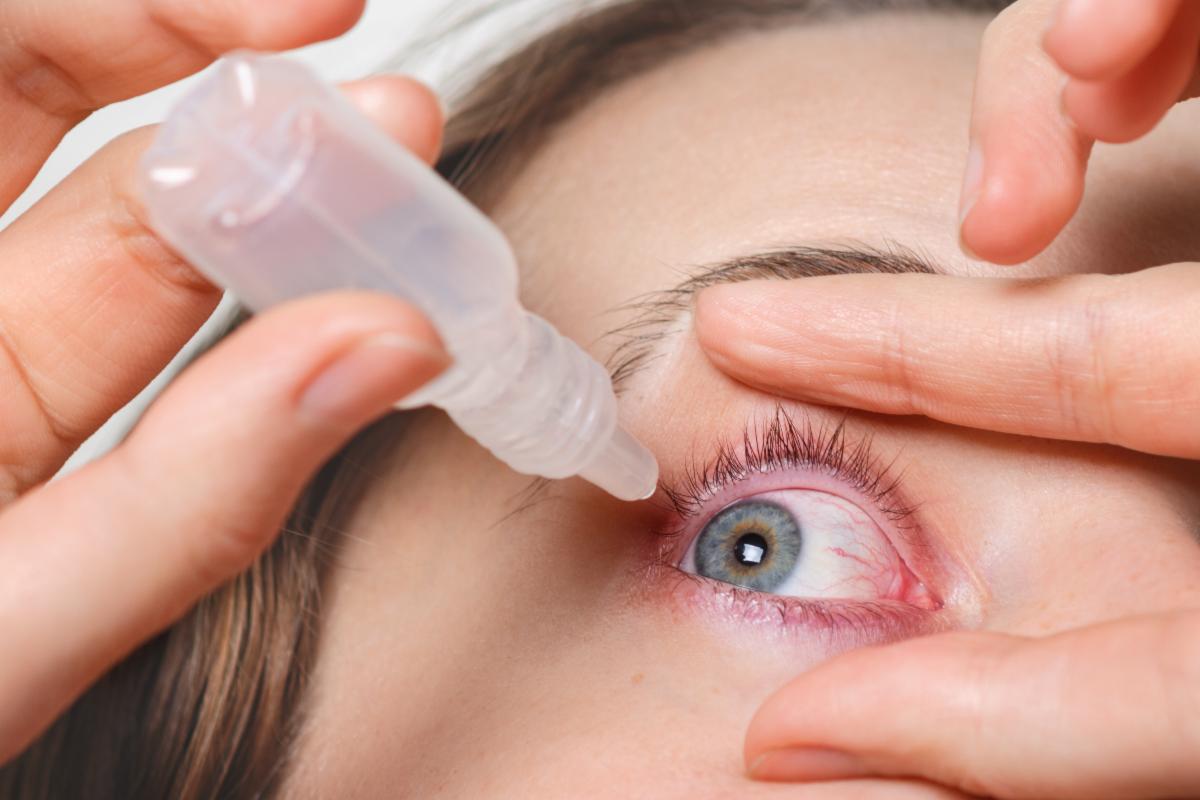 A person tilts their head back while using one hand to hold their eyelid open and the other hand to squeeze a bottle of eye drops above the eye, with the liquid about to enter the eye.