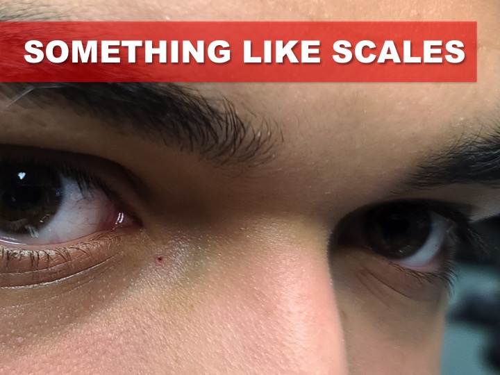 SOMETHING LIKE SCALES NEWS FROM THE SALEM4YOUTH RANCH