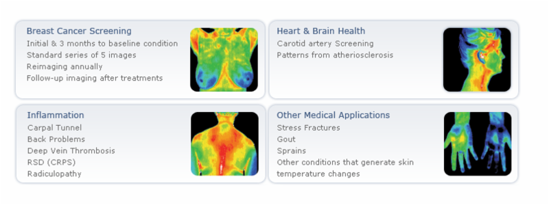 Thermography