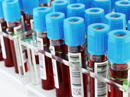 Why Regular Blood Test Are Important