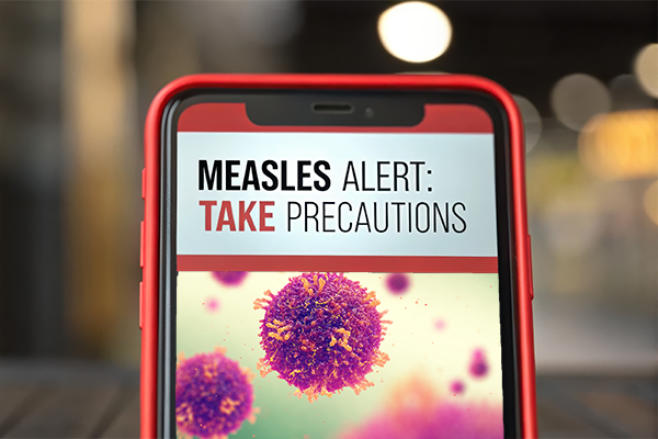 Measle alert