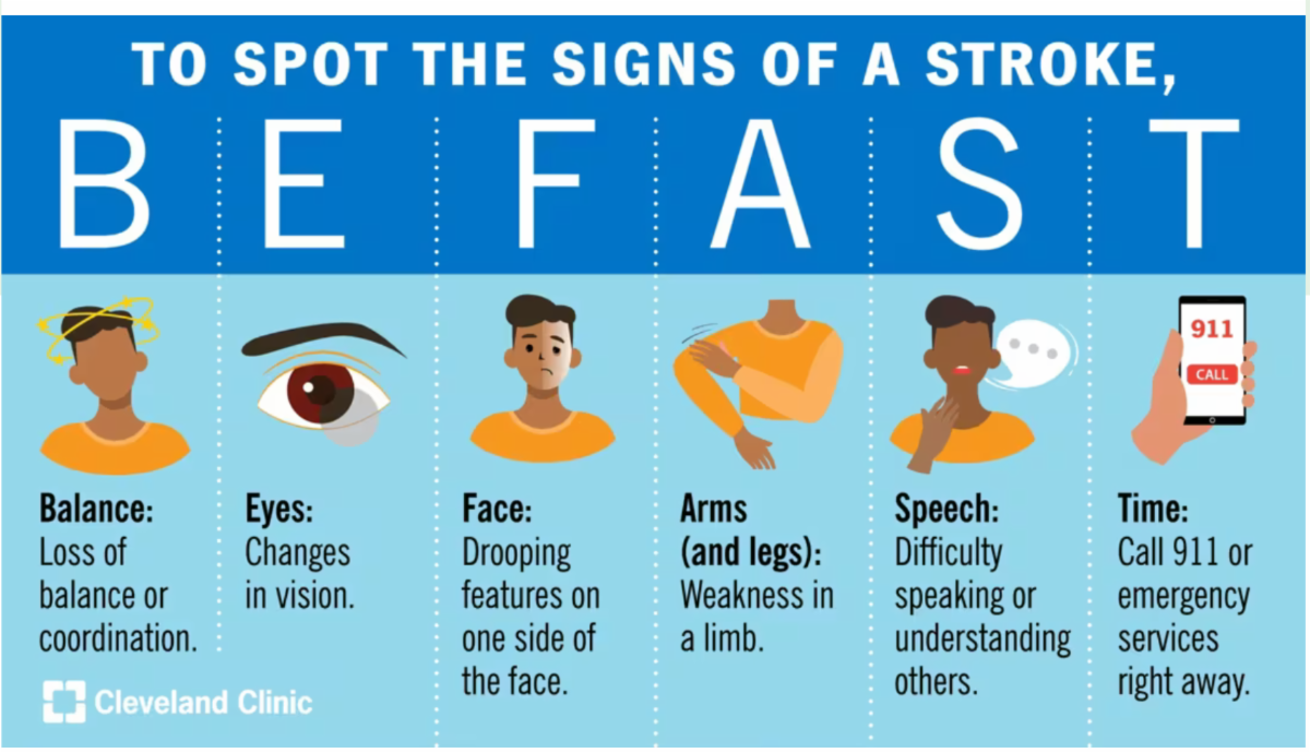 stroke signs