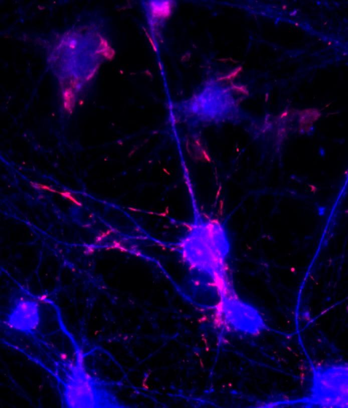neuron_with_rods