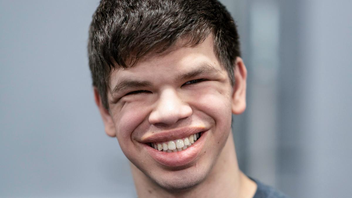 A young man with Williams Syndrome smiles