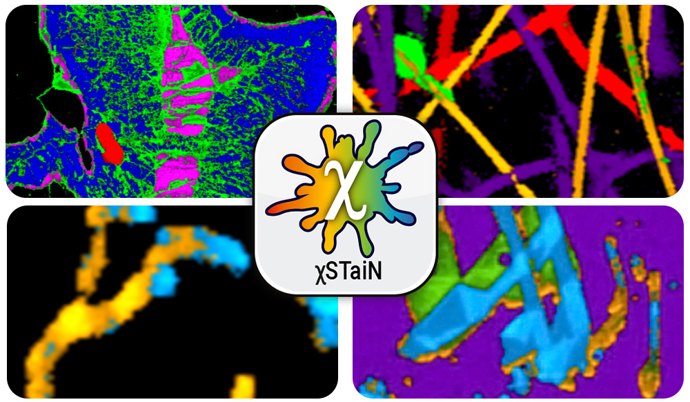LabSpec 6 Enjoy a wonderful User eXperience with the unique features