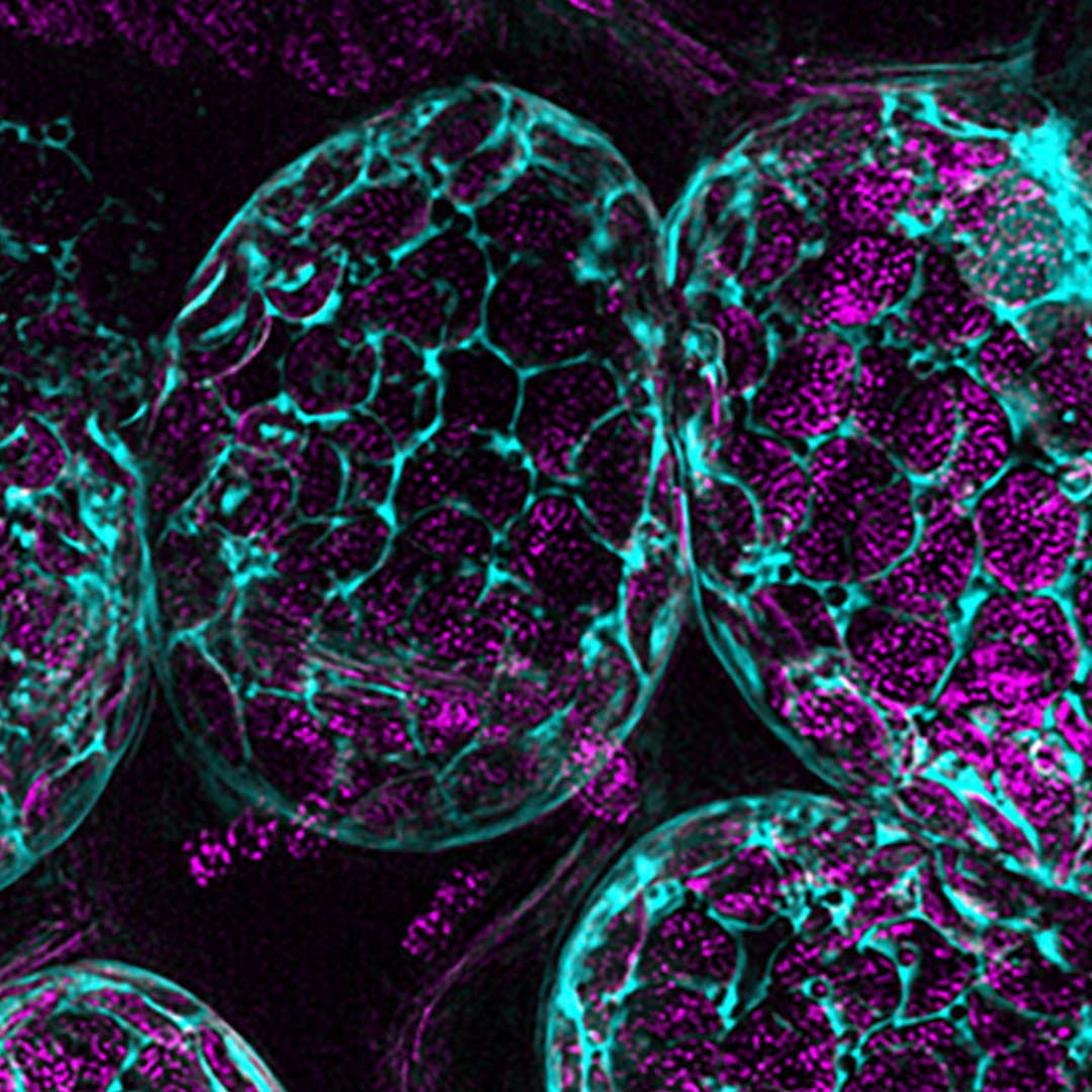 Mesophyll Cells with Chloroplasts.