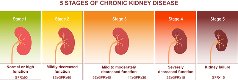 Chronic kidney disease stages and testing information