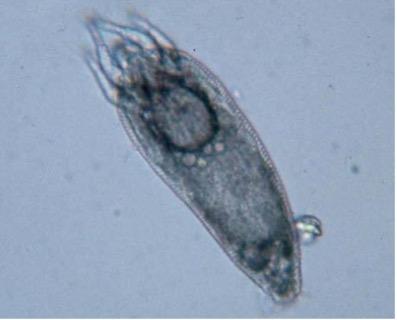 Phyllocoptes fructiphilus, the Tiny Eriophyid Mite that Transmits RRV