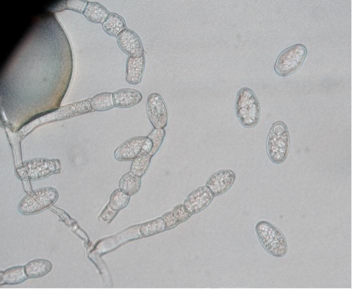 Spores of Powdery Mildew, 40x Magnification