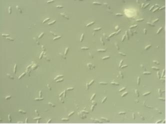Spores of Colletotrichum, the Causal Agent of Strawberry Anthracnose Crown Rot (40X Magnification)
