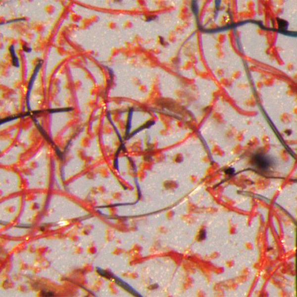 Microplastics