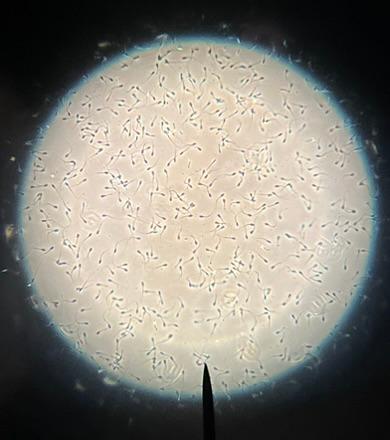 semen under scope