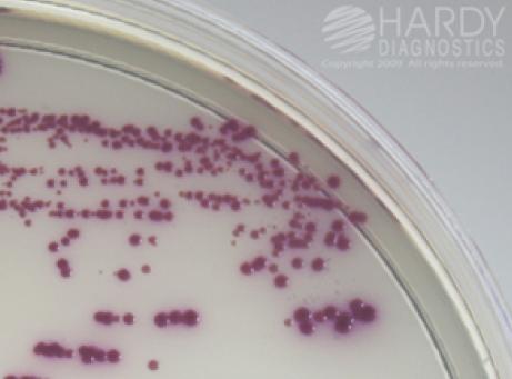 HC MRSA 48 hours