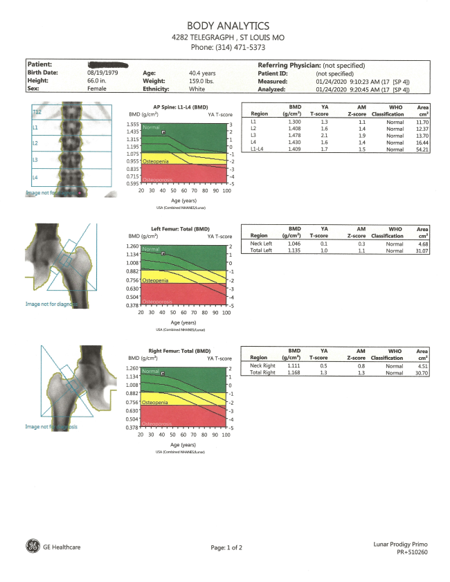 Check Out This Great Offer For OsteoStrong Members Only check out this great offer for osteostrong members only